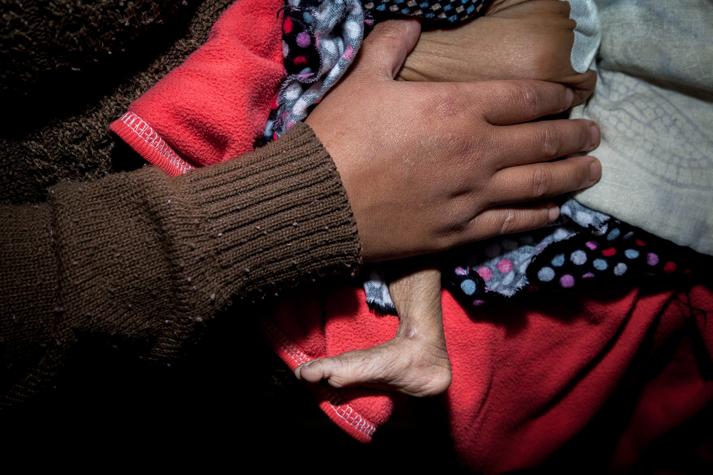 AGRICULTURE AND FOOD PORTFOLIO A malnourished boy is held by his mother in Nepal